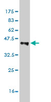 Western blot against tagged recombinant protein immunogen using ab54822 ASAH1 antibody at 1ug/ml.
