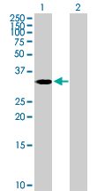 All lanes : Anti-ASB4 antibody (ab76913) at 5 µg/mlLane 1 : ASB4 transfected 293T cell lysateLane 2 : Non transfected 293T cell lysateLysates/proteins at 25 µg per lane.SecondaryGoat Anti-Mouse IgG (H&L)-HRP Conjugate at 1/2500 dilution