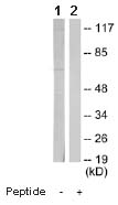 All lanes : Anti-ASC1 antibody (ab64966) at 1/500 dilutionLane 1 : extracts from K562 cells, without immunising peptideLane 2 : extracts from K562 cells, with immunising peptide