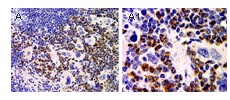 Immunhistochemical analysis of ASC2/POP1 expression in mouse spleen using ab47092 at 1:2000. Left and Right images: spleen at low and high magnification, respectively. ASC2/POP1 staining is seen in the granulocytes, whereas the lymph and megakaryocytes are negative.