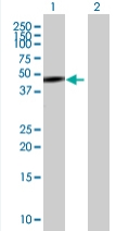 All lanes : Anti-ASCC1 antibody (ab67919) at 1/500 dilutionLane 1 : ASCC1 transfected 293T cell lysate at 25 µgLane 2 : Non transfected 293T cell lysate at 25 µgSecondaryGoat anti-mouse IgG (H&L)-HRP conjugate at 1/2500 dilution
