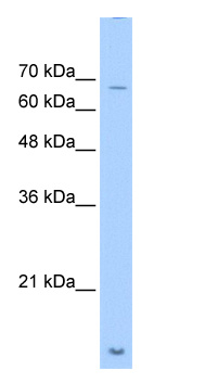 Anti-ASH2L antibody (ab28426) at 0.25 µg/ml + Jurkat cell lysateSecondaryHRP-conjugated anti rabbit IgG diluted 1/50,000 - 1/100,000