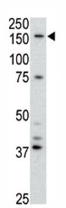 Anti-ABCB4 antibody (ab71792) at 1/100 dilution + Mouse heart tissue lysates at 12.5 µgSecondaryHRP-anti-rabbit