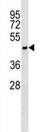 Anti-Asialoglycoprotein Receptor 1 antibody (ab123792) at 1/100 dilution + MDA-MB231 cell line lysate at 35 µg