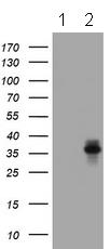 All lanes : Anti-Asialoglycoprotein Receptor 2 antibody [2A12] (ab139298) at 1/4000 dilutionLane 1 : HEK293T cells transfected with pCMV6-ENTRY control cDNALane 2 : HEK293T cells transfected the pCMV6-ENTRY Asialoglycoprotein Receptor 2 cDNA Lysates/proteins at 5 µg per lane.