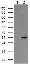 All lanes : Anti-Asialoglycoprotein Receptor 2 antibody [4B6] (ab156792) at 1/4000 dilutionLane 1 : HEK293T cells transfected with pCMV6-ENTRY control cDNALane 2 : HEK293T cells transfected with pCMV6-ENTRY Asialoglycoprotein Receptor 2 cDNALysates/proteins at 5 µg per lane.