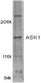 Anti-ASK1 antibody (ab2004) at 1/500 dilution + SW1351 whole cell lysate