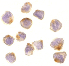 ab2004 at 10µg/ml staining ASK1 in A431 cells by ICC/IF