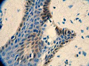 ab32377 at a 1:250 dilution staining 14-3-3 alpha + beta in human skin using Immunohistochemistry, Paraffin Embedded Tissue.