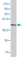Western blot against tagged recombinant protein immunogen using ab54849 ASPA antibody at 1ug/ml.