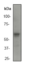 Anti-Asparagine synthetase antibody [EP282Y] (ab40850) at 1/2000 dilution + K562 cell lysate at 10 µg