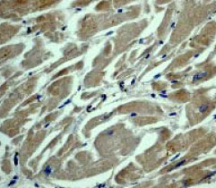 ab40850 at a 1:50 dilution staining Asparagine synthetase in human muscle tissue.