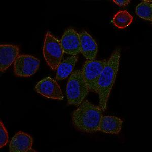 Immunofluorescent analysis of HepG2 cells labeling ABCB5 with ab140667 at 1/200 dilution (green); Blue: DRAQ5 fluorescent DNA dye. Red: Actin filaments have been labeled with Alexa Fluor-555 phalloidin.