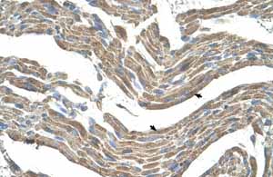 Immunohistochemistry (Formalin/PFA-fixed paraffin-embedded sections) analysis of human muscle tissue labelling Asporin with ab58741 at a concentration of 4-8µg/ml. Skeletal muscle cells (indicated by arrows) were positively stained. Magnification: 400X.