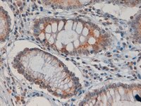 ab31303 (4µg/ml) staining of paraffin embedded Human Colon. Steamed antigen retrieval with citrate buffer pH 6, HRP-staining. Shows textured staining in the cytoplasm of absorptive cells. 