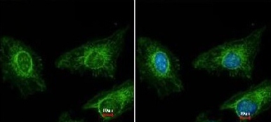 Immunofluorescence analysis of methanol-fixed HeLa cells, labeling Asporin using ab154404 at 1/200 dilution. Right panel costained with Hoechst 33342.