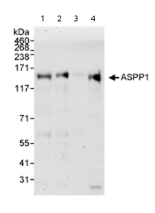 All lanes : Anti-ASPP1 antibody (ab71163) at 0.1 µg/mlLane 1 : Whole cell lysate from 293T cells at 50 µgLane 2 : Whole cell lysate from 293T cells at 15 µgLane 3 : Whole cell lysate from 293T cells at 5 µgLane 4 : Whole cell lysate from Hela cells at 50 µgdeveloped using the ECL technique