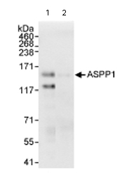 Immunoprecipitation/ Western Blot of ASPP1. Lane 1: ab71163 at 3µg/mg whole cell lysate. Lane 2: Control IgG. All lanes: Whole cell lysate from Hela cells at 1mg for IP, 20% of IP loaded. Detection: Chemiluminescence with an exposure time of 10 seconds.