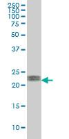 Anti-ATF3 antibody (ab54854)
