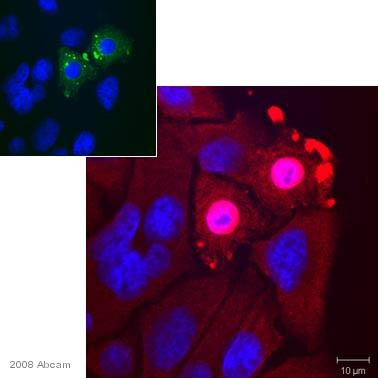 ab37149 staining human Hella cells by ICC/IF. Cells were PFA fixed and permeabilized for 10 minutes in 0.1% Triton X-100 prior to blocking in 3% BSA for 15 minutes at 25°C. The primary antibody was diluted 1/200 and incubated with the sample for 1 hour. The secondary antibody used was Alexa Fluor®568 goat anti-rabbit (ab175471) diluted at 1/1000.See Abreview