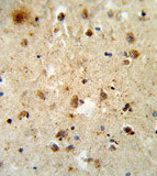 Immunohistochemical analysis of Formalin-fixed, Paraffin-embedded Human brain tissue labelling ATF6 with ab135707 at 1/50 dilution followed by peroxidase-conjugated secondary antibody and DAB staining.