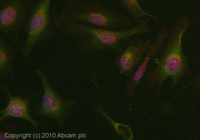 ICC/IF image of ab83504 stained HeLa cells. The cells were 4% PFA fixed (10 min) and then incubated in 1%BSA / 10% normal Goat serum / 0.3M glycine in 0.1% PBS-Tween for 1h to permeabilise the cells and block non-specific protein-protein interactions. The cells were then incubated with the antibody (ab83504, 1µg/ml) overnight at +4°C. The secondary antibody (green) was Alexa Fluor® 488 Goat anti-Rabbit IgG (H+L) used at a 1/1000 dilution for 1h. Alexa Fluor® 594 WGA was used to label plasma membranes (red) at a 1/200 dilution for 1h. DAPI was used to stain the cell nuclei (blue) at a concentration of 1.43µM.