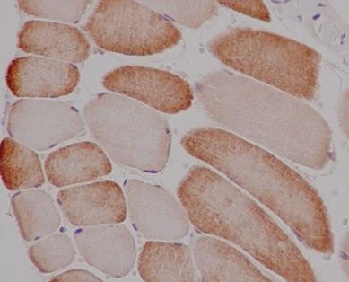Immunohistochemical analysis of paraffin-embedded Human skeletal muscle tissue labeling ATG4C with ab183516 at 1/250 dilution. The slide is counterstained with Hematoxylin.