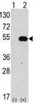 All lanes : Anti-ATG4C antibody - N-terminal (ab173796) at 1/60 dilutionLane 1 : Non-transfected 293 cell line lysatesLane 2 : 293 cell line lysates transiently transfected with the ATG4C geneLysates/proteins at 2 µg per lane.
