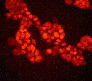 Immunofluorescent staining of  293 cells with ab32420 at a 1/100 dilution.