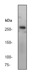 Anti-ATM antibody [Y170] (ab32420) at 1/5000 dilution (Unpurified) + 293 cell lysate.