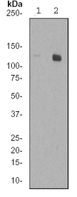 All lanes : Anti-ATP citrate lyase (phospho S455) antibody [EP828Y] (ab46796) at 1/5000 dilutionLane 1 : Untreated 3T3 cell lysatesLane 2 : Insulin treated 3T3 cell lysatesLysates/proteins at 10 µg per lane.SecondaryGoat anti-rabbit HRP at 1/2000 dilutionObserved band size : 125 kDa (why is the actual band size different from the predicted?)