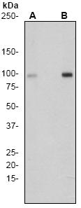 All lanes : Anti-ATP citrate lyase (phospho T447 + S451) antibody [EP737Y] (ab53007) at 1/1000 dilutionLane 1 : (A) 3T3 cell lysate (untreated cells)Lane 2 : (B) 3T3 cell lysate (insulin treated cells)Lysates/proteins at 10 µg per lane.Secondarygoat anti-rabbit HRP labelled at 1/2000 dilution