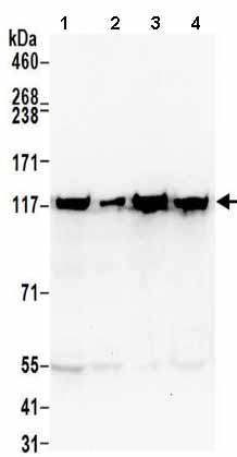 All lanes : Anti-ATP citrate lyase antibody (ab157098) at 0.4 µg/mlLane 1 : Jurkat whole cell lysate at 50 µgLane 2 : Jurkat whole cell lysate at 15 µgLane 3 : HeLa whole cell lysate at 50 µgLane 4 : 293T whole cell lysate at 50 µgdeveloped using the ECL technique