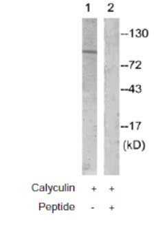 All lanes : Anti-ATP citrate lyase antibody (ab61762) at 1/500 dilutionLane 1 : Extracts from COS7 cells, treated with Calyculin (50nM, 30mins).Lane 2 : Extracts from COS7 cells, treated with Calyculin (50nM, 30mins) and the immunising peptide.