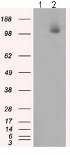 All lanes : Anti-ATP citrate lyase antibody [3G8] (ab118150) at 1/2000 dilutionLane 1 : HEK293T cell lysate transfected with pCMV6-ENTRY control cDNALane 2 : HEK293T cell lysate transfected with pCMV6-ENTRY ATP citrate lyase cDNALysates/proteins at 5 µg per lane.