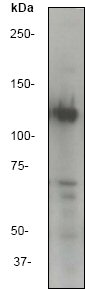 Anti-ATP citrate lyase antibody [EP704Y] (ab40793) at 1/5000 dilution + Hela cell lysate.