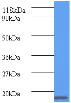 Anti-ATP-dependent Clp protease adapter protein ClpS antibody (ab193643) at 2 µg/ml + DH5a lysateSecondaryGoat polyclonal to Rabbit IgG at 1/10000 dilution