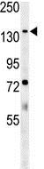 Anti-ATP11C antibody (ab175055) at 1/100 dilution + Mouse lung tissue lysate at 35 µg