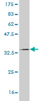 Western blot against tagged recombinant protein immunogen using ab57080 ATP13A2 antibody at 1ug/ml.