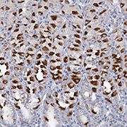 ab122537, at 1/40 dilution, staining ATP4A in paraffin-embedded Human stomach tissue by Immunohistochemistry.