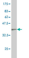 Western blot against tagged recombinant protein immunogen using ab57363 ATP6V1D antibody at 1ug/ml.