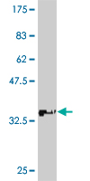 Western blot against tagged recombinant protein immunogen using ab54792 ATP7b antibody at 1ug/ml.