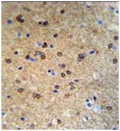 Immunohistochemical analysis of Formalin-fixed, Paraffin-embedded Mouse brain tissue labelling ATP7b with ab135571 at 1/50 dilution followed by peroxidase-conjugated secondary antibody and DAB staining.