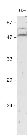 Anti-atpA antibody (ab65369) at 1/2000 dilution + Synechocystis sp. PCC 6803 thylakoids at 3 µg