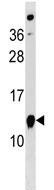 Anti-ATPase Inhibitory Factor 1 antibody - Aminoterminal end (ab139125) at 1/100 dilution + K562 cell line lysates at 35 µg