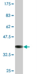 Anti-ATPase Na+/ K+ beta 2 antibody (ab76509) at 5 µg/ml + immunogen at 0.2 µgSecondaryGoat Anti-Mouse IgG (H&L)-HRP Conjugate at 1/5000 dilution