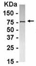 Anti-ATPB antibody (ab37922) at 1/2000 dilution + E coli-derived fusion protein at 2.5 µgSecondaryGoat anti-IgY-HRP at 1/1000 dilution