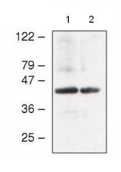 All lanes : Anti-atpC antibody (ab65381) at 1/1000 dilutionLane 1 : Arabidopsis thaliana choloroplast proteins Lane 2 : Arabidopsis thaliana thylakoid proteins
