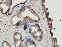 ABCF2 antibody (ab56790) used in immunohistochemistry at 3ug/ml on formalin fixed and paraffin embedded human prostate.