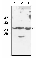 All lanes : Anti-atpI antibody (ab65384) at 1/2000 dilutionLane 1 : Arabidopsis chloroplast proteinsLane 2 : Tobacco chloroplast proteinsLane 3 : Spinach chloroplast proteinsdeveloped using the ECL technique